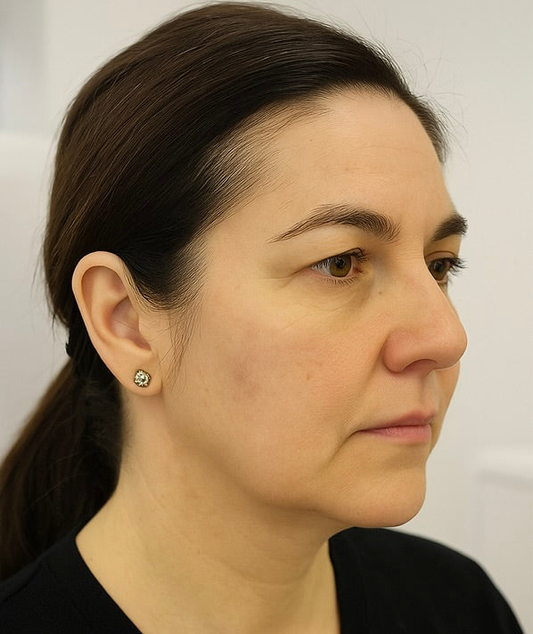 Before image