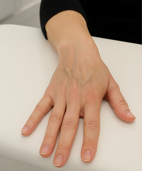 Before image