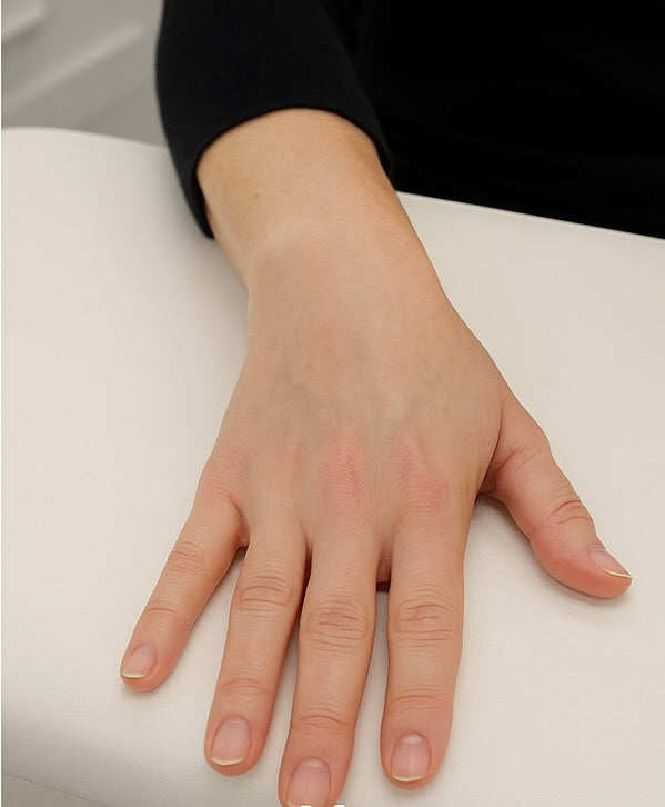 After image