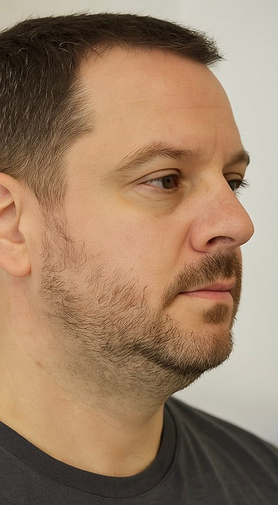 Before image