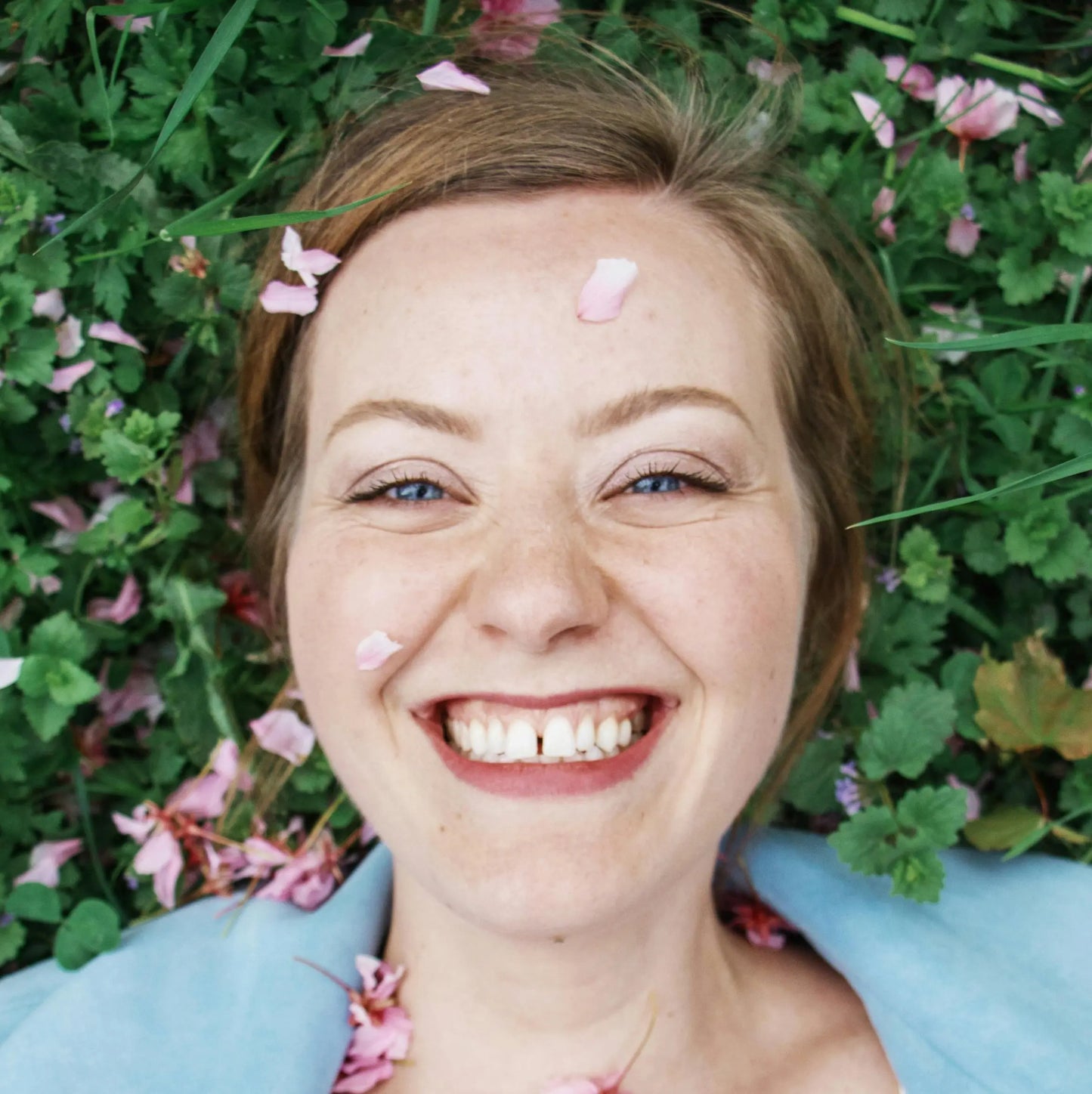 Gummy Smile HAUS OF ÄSTHETIK