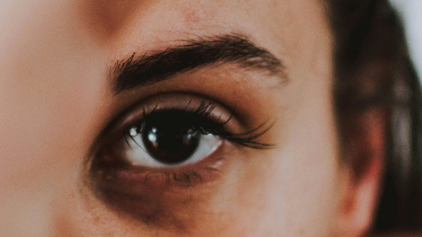 Crows Feet